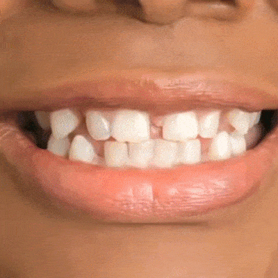 width=400