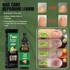🔥Nail treatment - Natural antifungal care