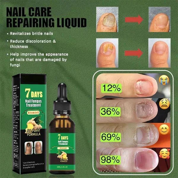 Last Day 50% OFF💕Ginger Nail Care Oil