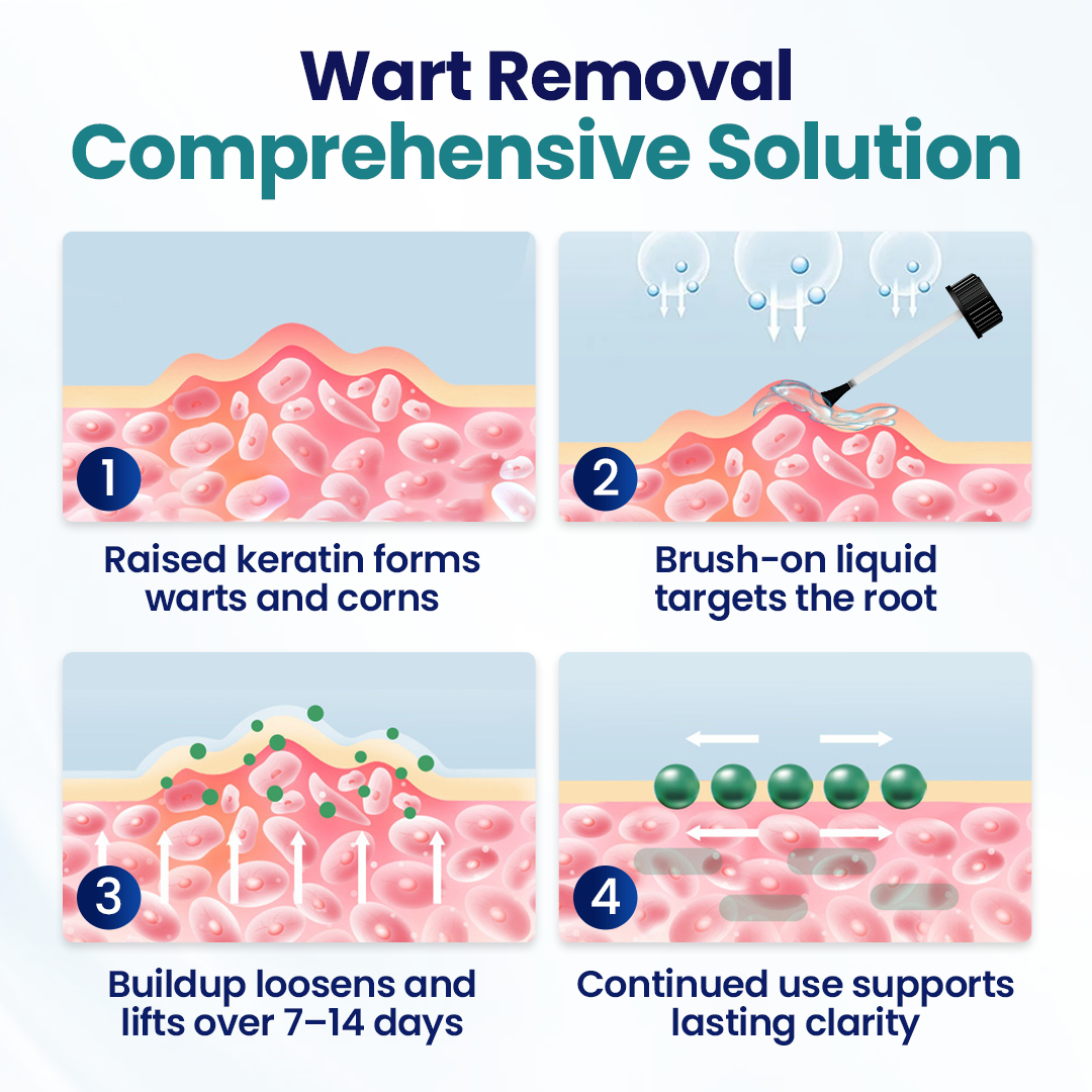 ROSOPL® WartLift Wart Removal Fluid 26 Timilk® WartLift Corn Removal Liquid (A)