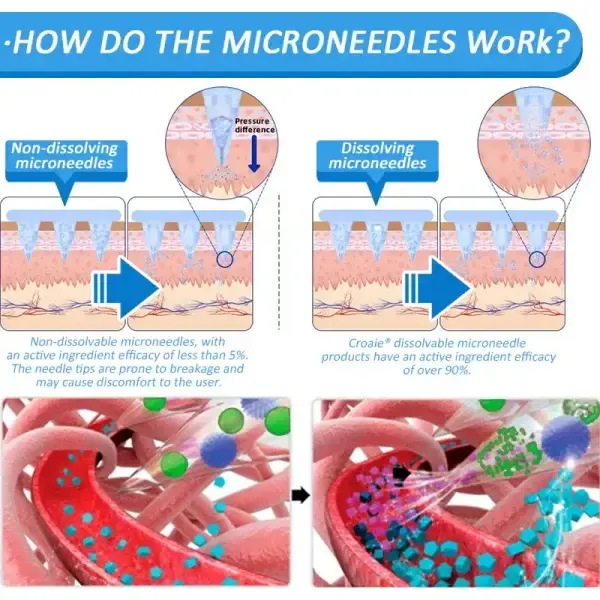 	Croaie&reg; SMGT-GLP-1 Nano Microneedle Patch