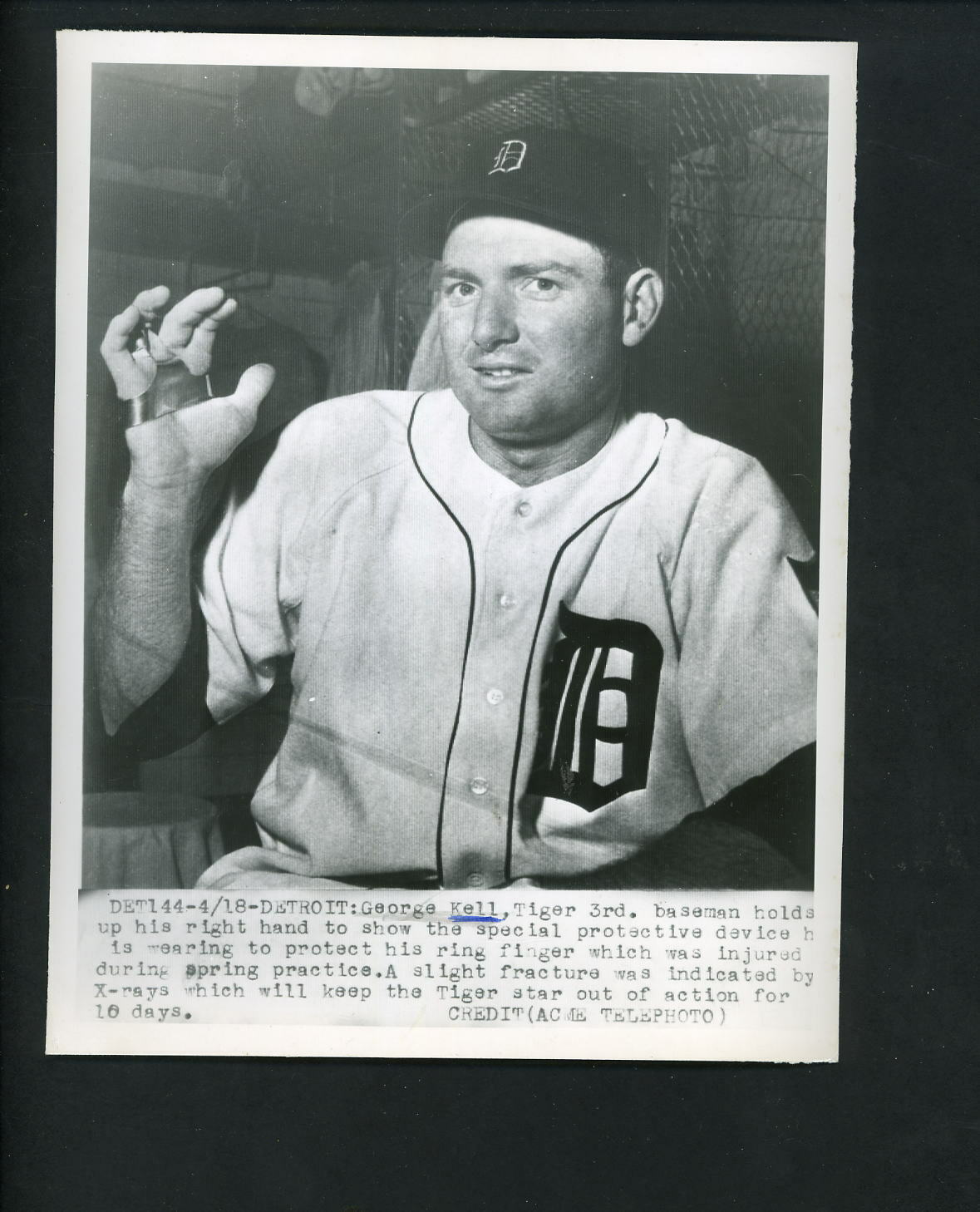 George Kell injured finger 1951 Press Photo Poster painting Detroit Tigers