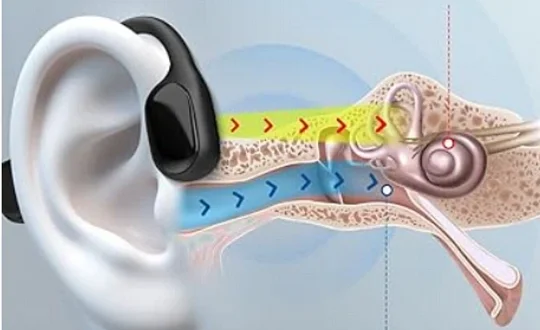🔥Limited-Time Offer🔥 Rediscover Clear Sound with the Bqyoom X2 Bone Conduction Hearing Aid