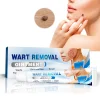 Maximum Performance Ointment for the Immediate removal of Warts