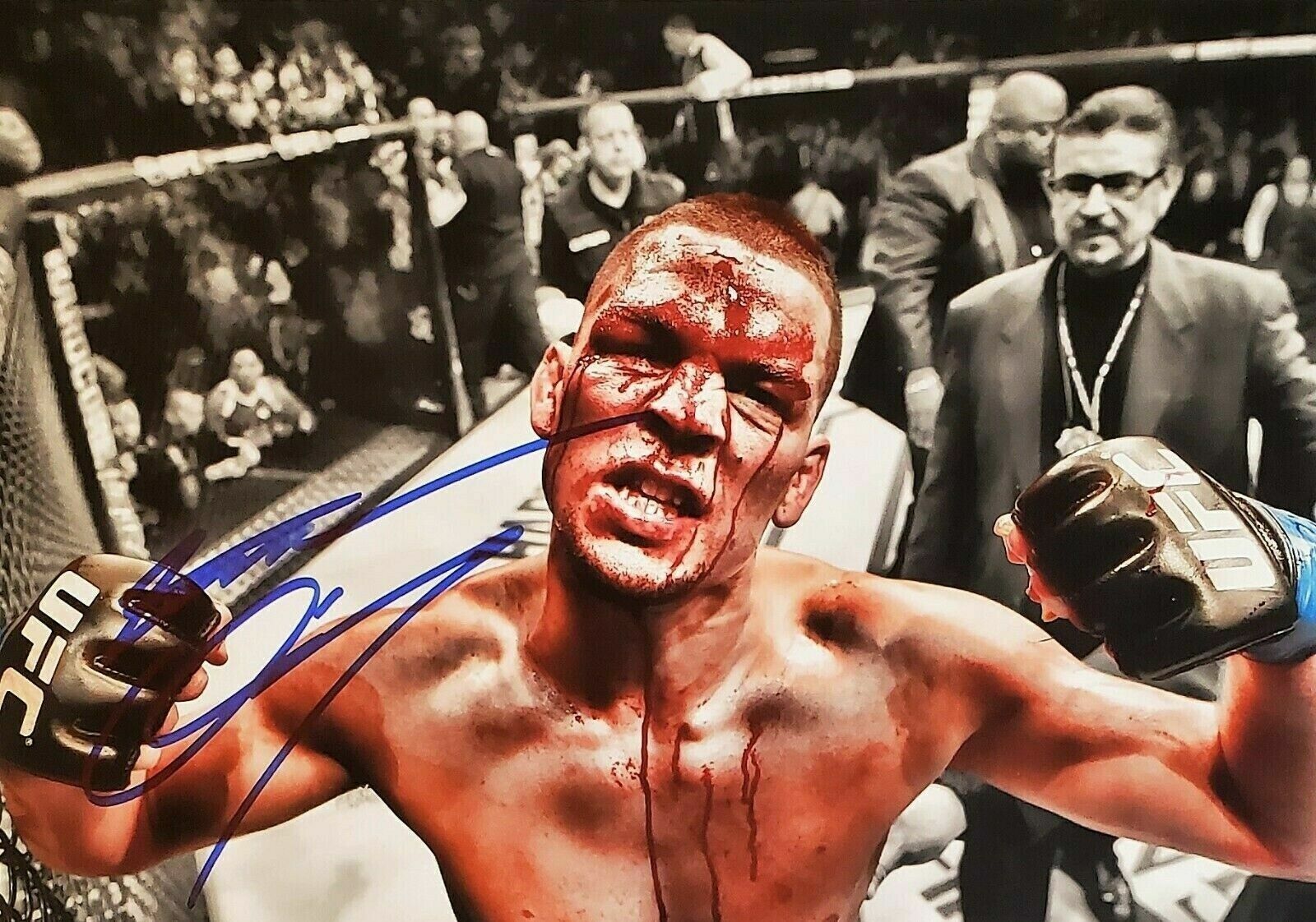 UFC Nate Diaz Autographed Signed 11x14 Photo Poster painting REPRINT