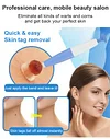 💥Double-head Wart Removal Tool - Remove your skin tags painlessly at home