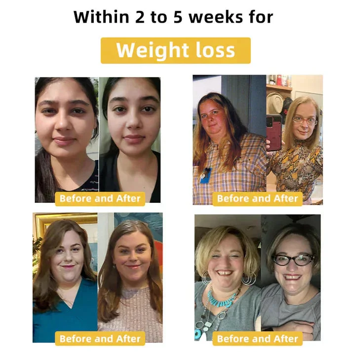 👩&zwj;⚕️👩&zwj;⚕️ 𝐂𝐯𝐫𝐞𝐨𝐳&trade; 𝐁𝐞𝐞 𝐕𝐞𝐧𝐨𝐦 𝐒𝐥𝐢𝐦𝐦𝐢𝐧𝐠 𝐏𝐚𝐭𝐜𝐡 🔥 (𝐟𝐨𝐫 𝐚𝐥𝐥 𝐥𝐲𝐦𝐩𝐡𝐚𝐭𝐢𝐜 𝐩𝐫𝐨𝐛𝐥𝐞𝐦𝐬 𝐚𝐧𝐝 𝐨𝐛𝐞𝐬𝐢𝐭𝐲)