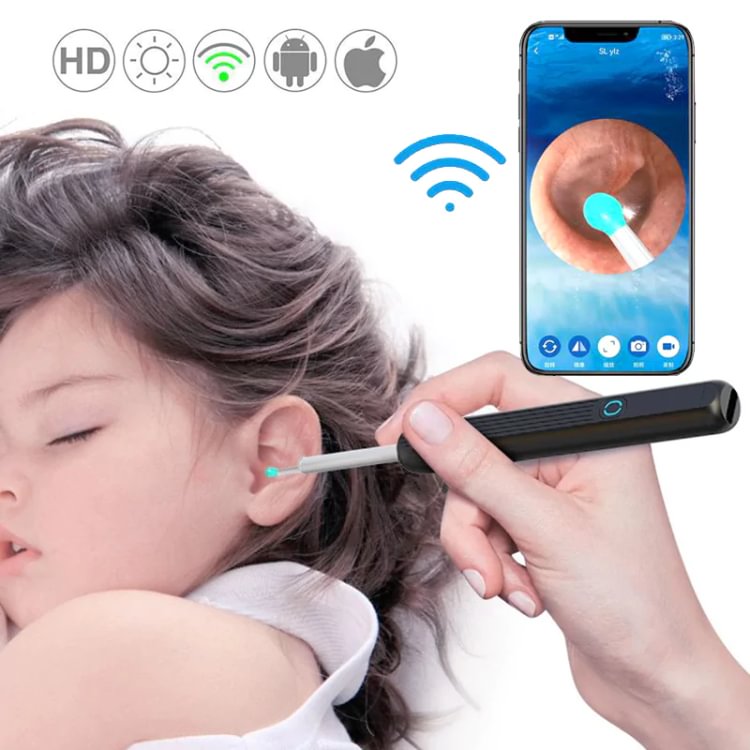 Clean Earwax - 1080p Intelligent Earwax Removal Otoscope