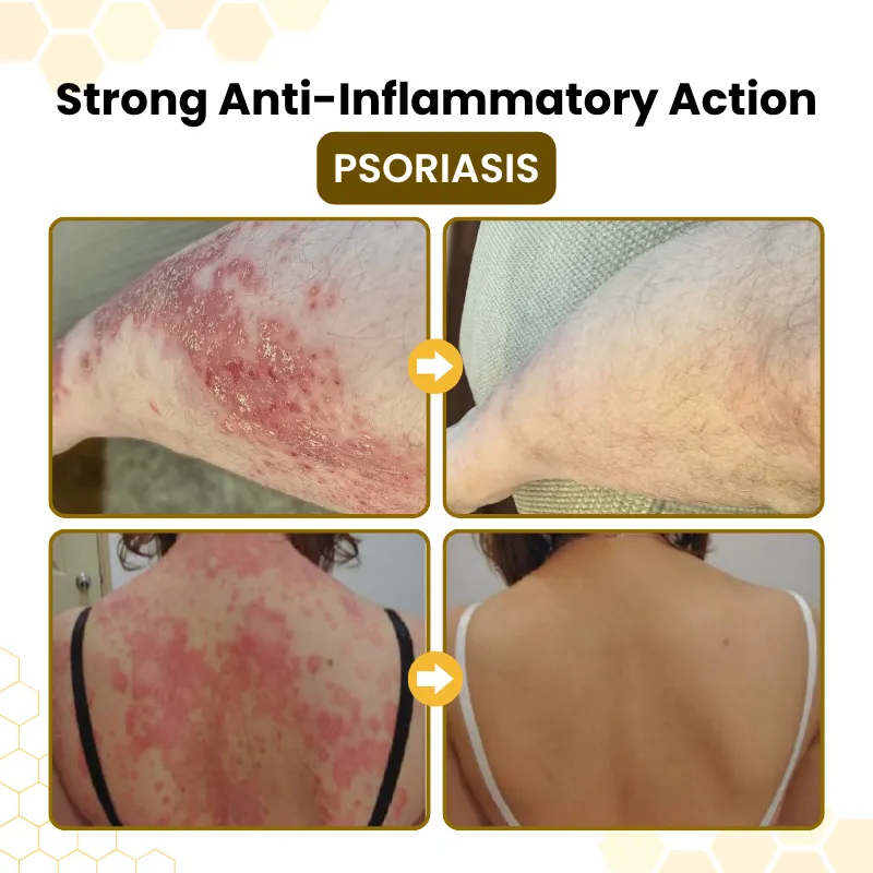 Dry flake-prone skin on hands and joints