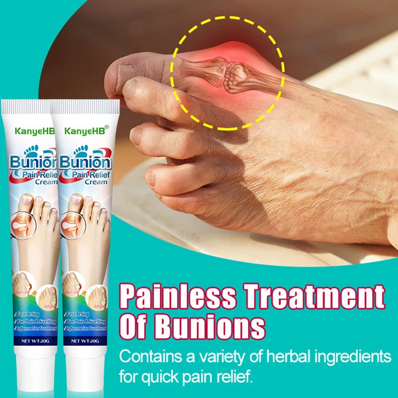 Joint Pain Cream Bunion Pain Relief Ointment Joint Toe Pain Relief Stiffness Arc
