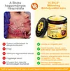 🌿 VLSVLS&reg; M&eacute;hm&eacute;reg Bőrhelyre&aacute;ll&iacute;t&oacute; Kr&eacute;m 🔥 UTOLS&Oacute; NAP &ndash; 80% KEDVEZM&Eacute;NY 🌟