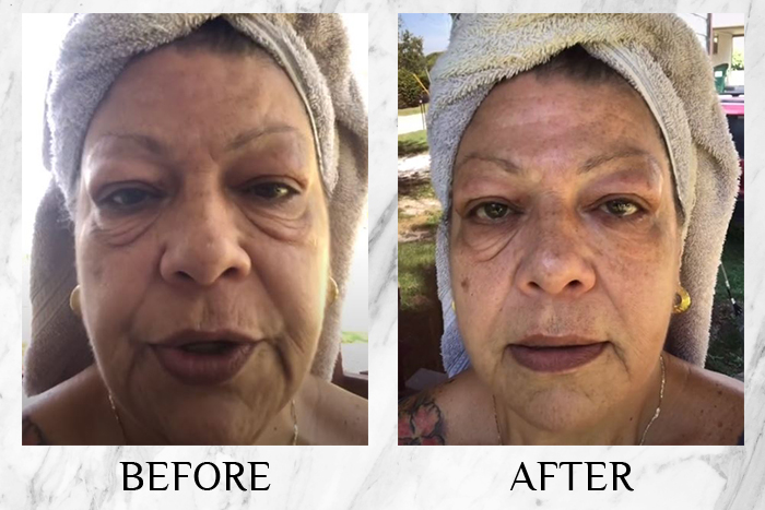 This eye cream went viral on TikTok & sold out in 4 days - here's why |  Daily Vanity Singapore