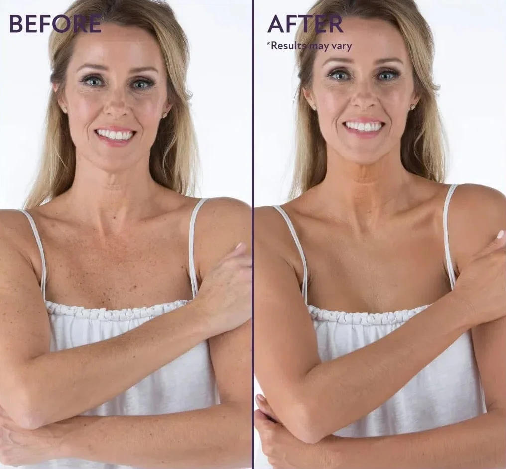 🌟Body Coverage Perfector &ndash; All-in-one moisturizer. concealer & coverage 💧✨ Lightweight & waterproof