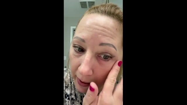 Instant FIRMx Eye Temporary Eye Tightener