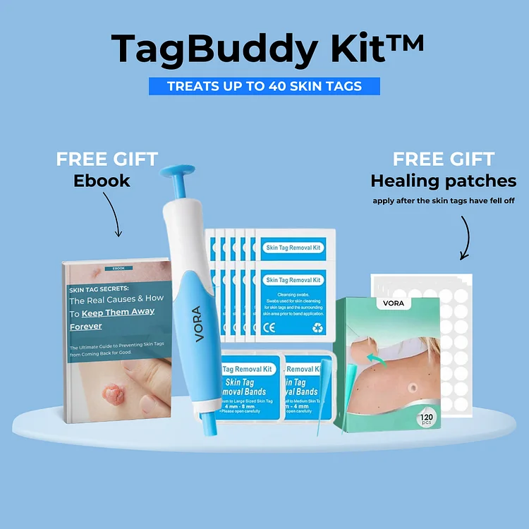 TagBuddy Kit&trade; - No More Skin Tags