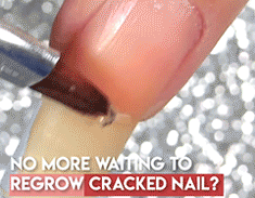 Instant Nail Repair Gel
