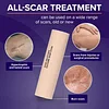 🔥Skin Scar Solutions🛡️ 60% Silicone Scar Stick.