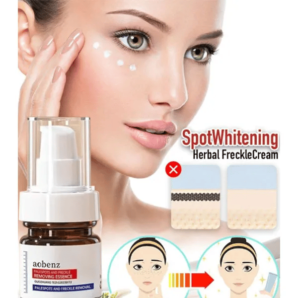 ✨Vitamin C Whitening Freckles Face Cream Remove Melasma Dark Spots Lighten Melanin