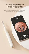 High-definition Video Ear Pick Smart Ear Cleaning Tool