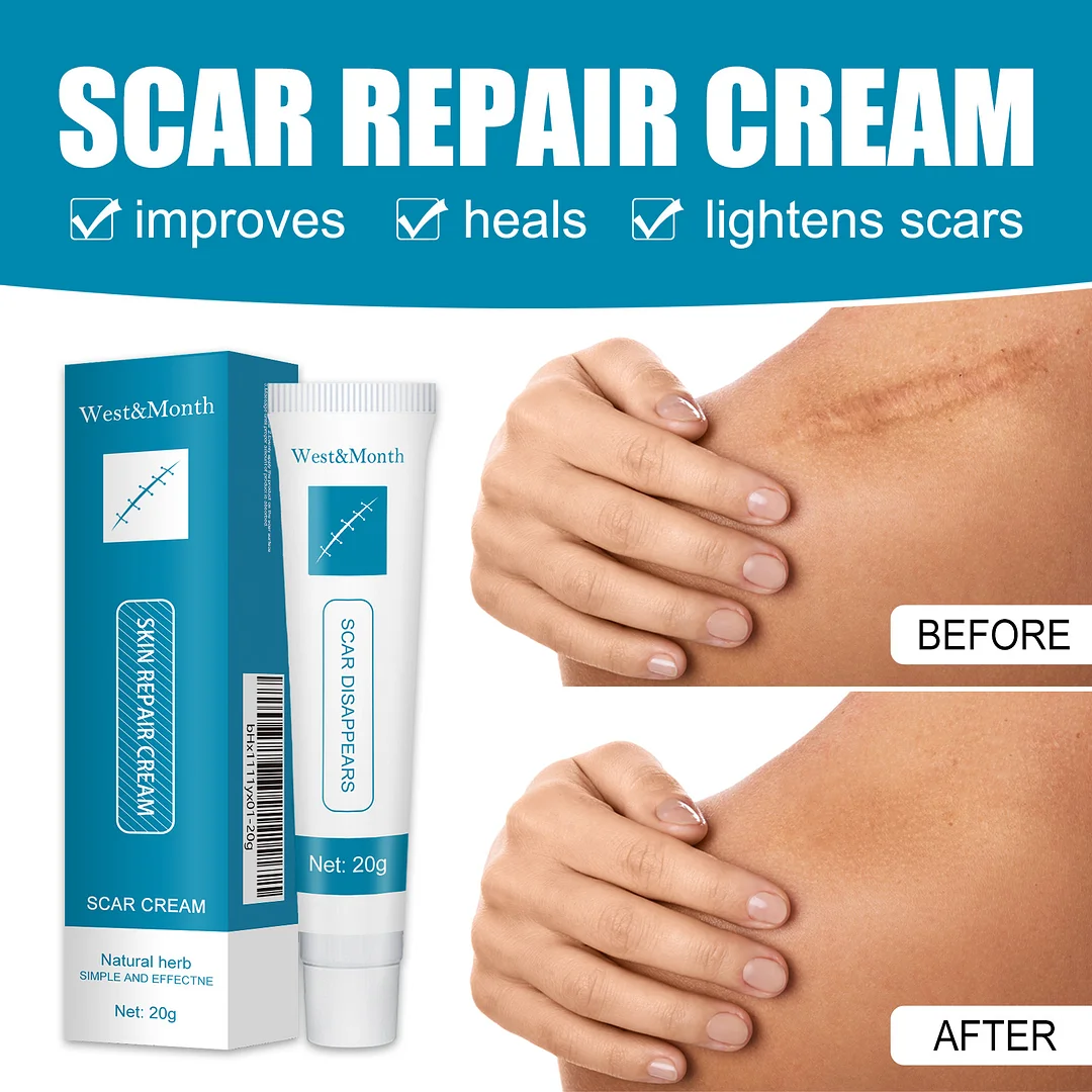 ⏰Limited Offer -Removing Scars, Scars And Lumps