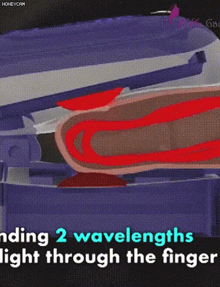 [#1 Best Products 2025]🔥Big Sale - 50% OFF🔥Non-Invasive Blood Glucose Meters