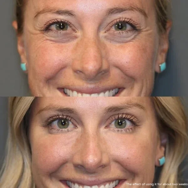 👁️Retinol Eye Cream Stick👁️🔥🔥