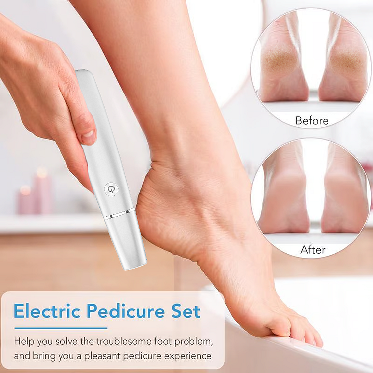 🎁Mother's Day Hot Sale 50%🌸Electric Feet Callus Remover✨