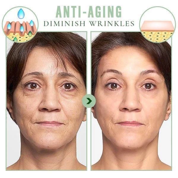 🔥HOT SALE🔥Wash-Free Korean Collagen Firming Mask