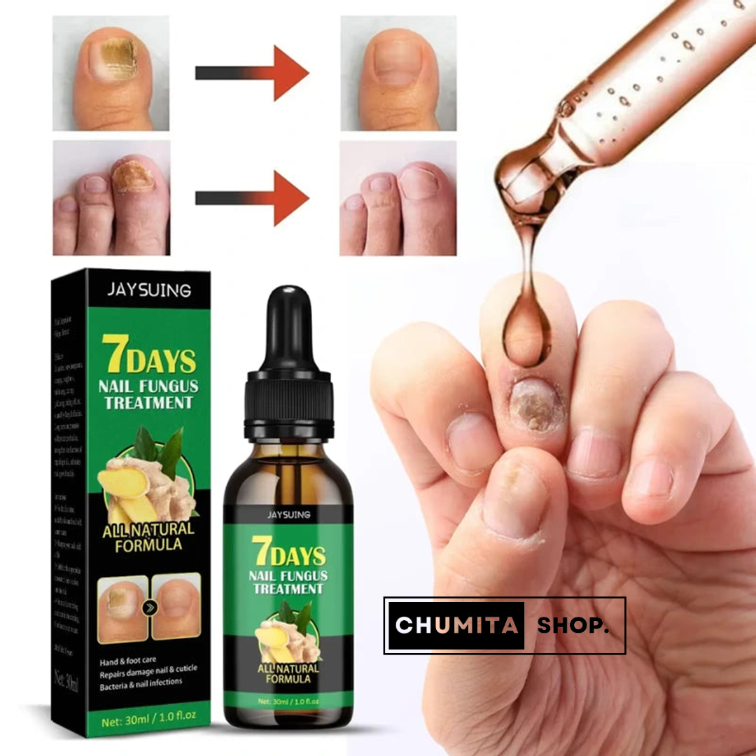  🔥Hot Sale 49% Off🔥- 7-Day Nail Growth and Repair Serum