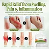 Vein Relief Cream