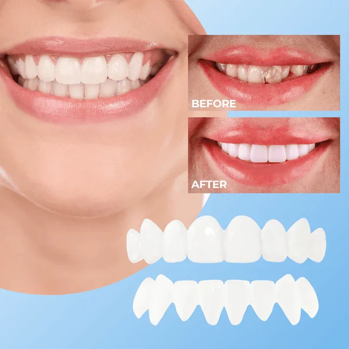 🦷Clip-On Teeth-Veneers