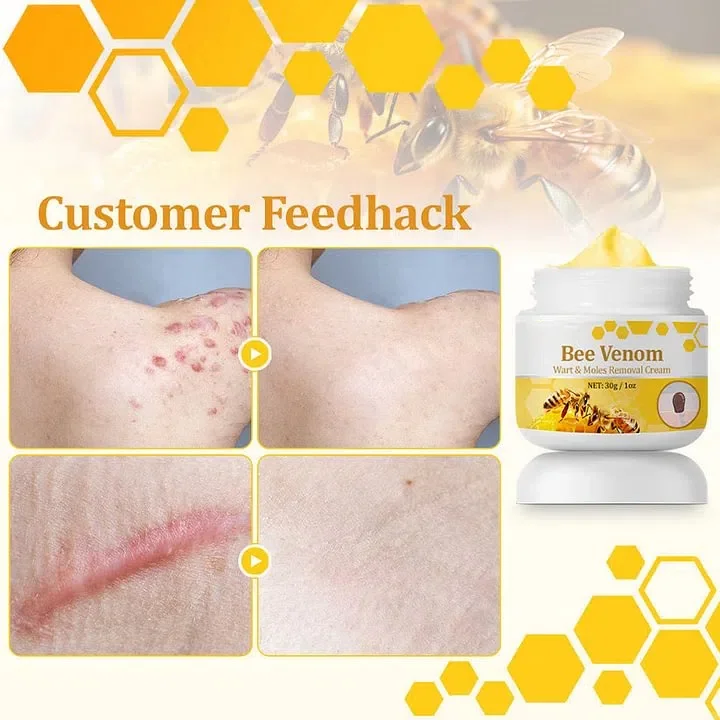 🐝👨‍⚕️ CAMPDP™ TagCure Bee Venom Skincare Cream, Certified by The British Association of Dermatologists (BAD) – Helps Treat Persistent Warts, Skin Tags, Skin Lesions, Infections, Scarring, and Smooth Uneven Skin 🌿