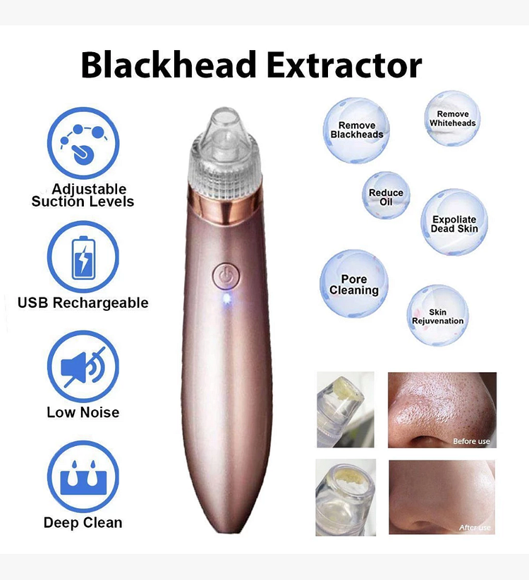 Blackhead Removal Extractor