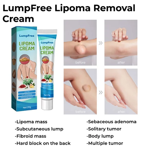 South Moon LumpFree Lipoma Removal Cream