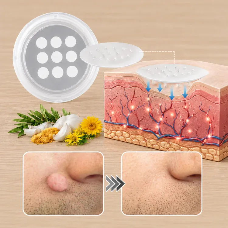NATRAVOR®2-in-1 Microneedle & Hydrocolloid Patch🍀| Removes Raised Moles, Acne, Flat Warts & Skin Tags | Helps Improve Wrinkles, Scars & Blemishes | Invisible Patches for Face & Body