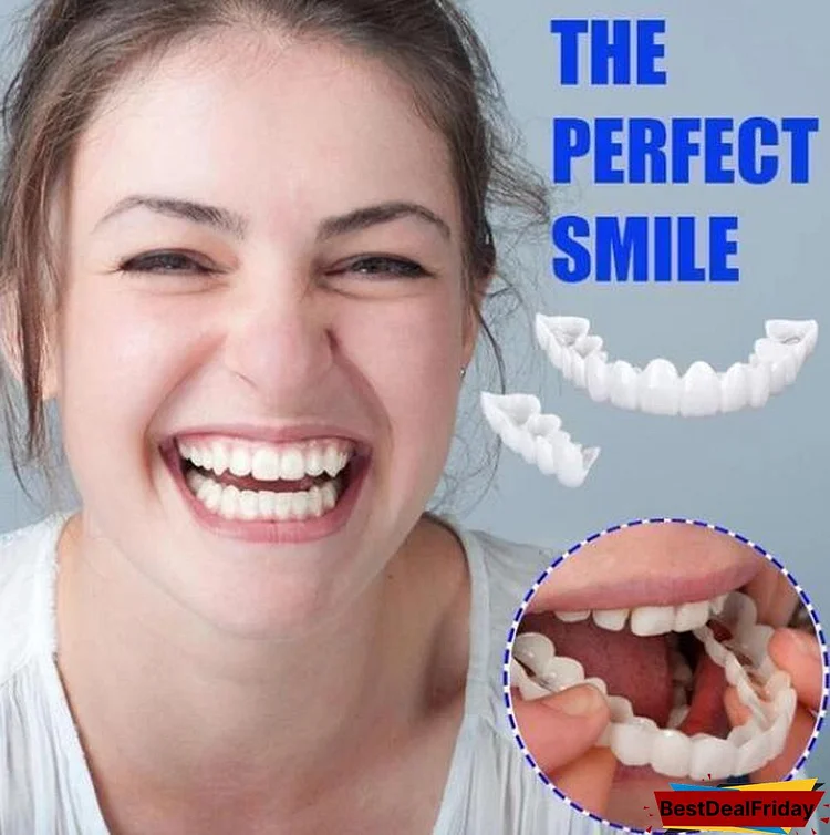 perfect smile snap on braces