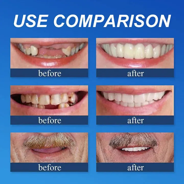 Ends Today: 70% OFF! ⏰ Medical Full Denture with Strong Suctiond🦷Obtain American Dental Association (ADA) Certification