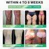 💥𝗭𝐖𝗘𝐄&reg; 𝑮𝑳𝑷-1 7-𝑫𝒂𝒚 𝑮𝒖𝒕 𝑪𝒍𝒆𝒂𝒏𝒔𝒆 & 𝑺𝒍𝒊𝒎 𝑺𝒖𝒑𝒑𝒐𝒓𝒕 𝑶𝒓𝒂𝒍 𝑺𝒐𝒍𝒖𝒕𝒊𝒐𝒏-(𝐎𝐧𝐜𝐞 𝐚 𝐝𝐚𝐲, 𝐫𝐞𝐬𝐮𝐥𝐭𝐬 𝐢𝐧 𝟕 𝐝𝐚𝐲𝐬)