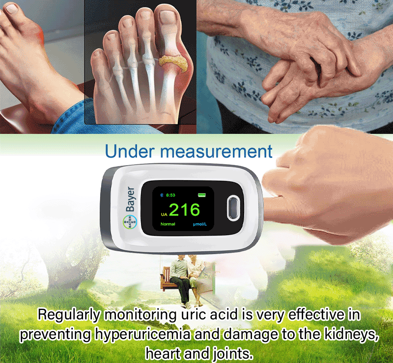 Prueba de &aacute;cido &uacute;rico.gif