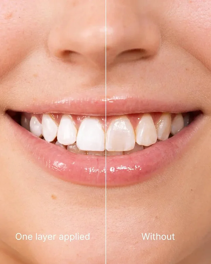 Smileasego™ Tooth Whitening - Instant Clean Smile