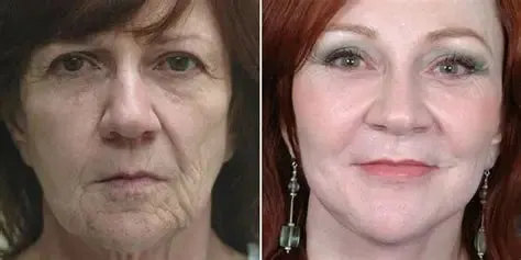 Newyuo™ Anti-Wrinkle & Firming Collagen Cream
