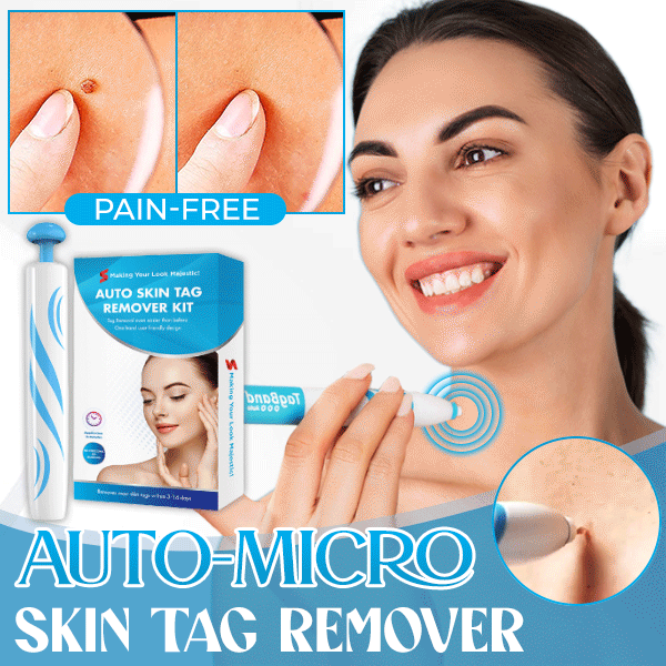 Auto Micro Skin Tag Remover