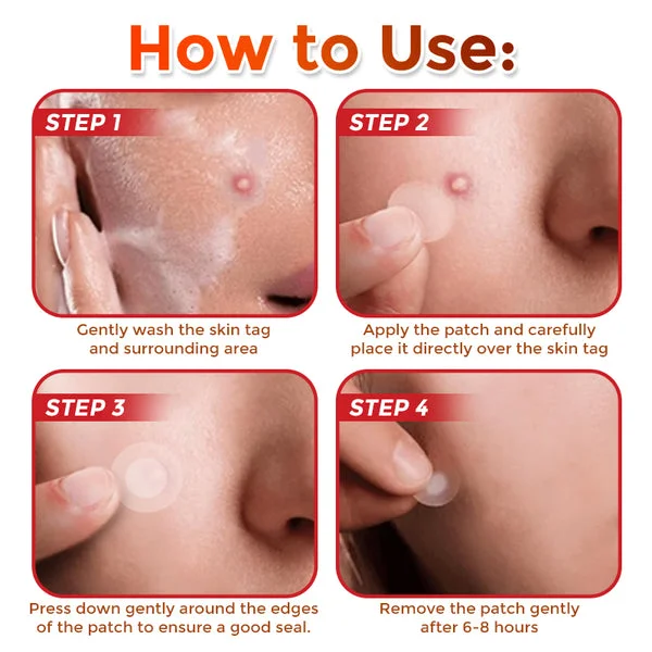 Yunpso™ MicroNeedle Botanic Skin Tag Removal Patch