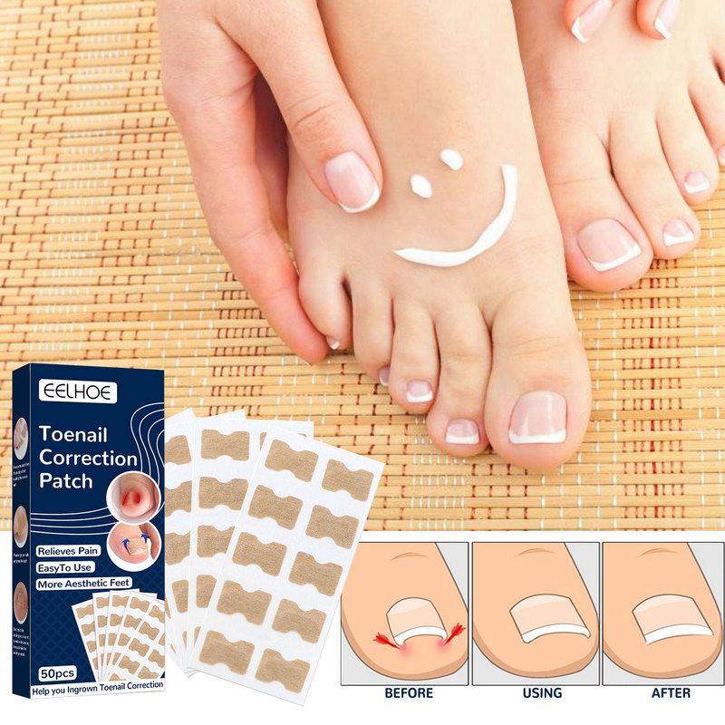EELHOE-Toenail correction patch
