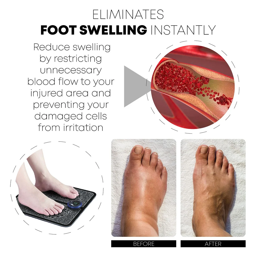 Bio-EMS Acupoint Massager Mat