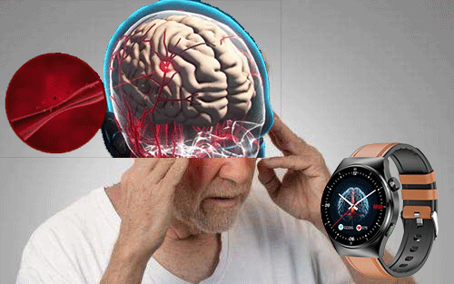 1704638349623635.gif Zawał mózgu.gif