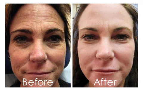 50% OFF Sale! EELHOE Collagen Anti-Wrinkle Cream