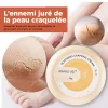 Cr&egrave;me anti-d&eacute;chirure pour peau d'hiver