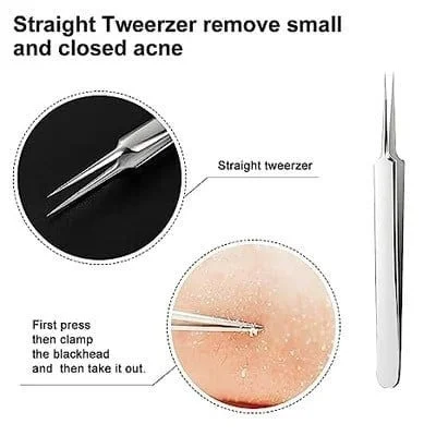 Facial Blackhead Remover Tweezers（3PCS）