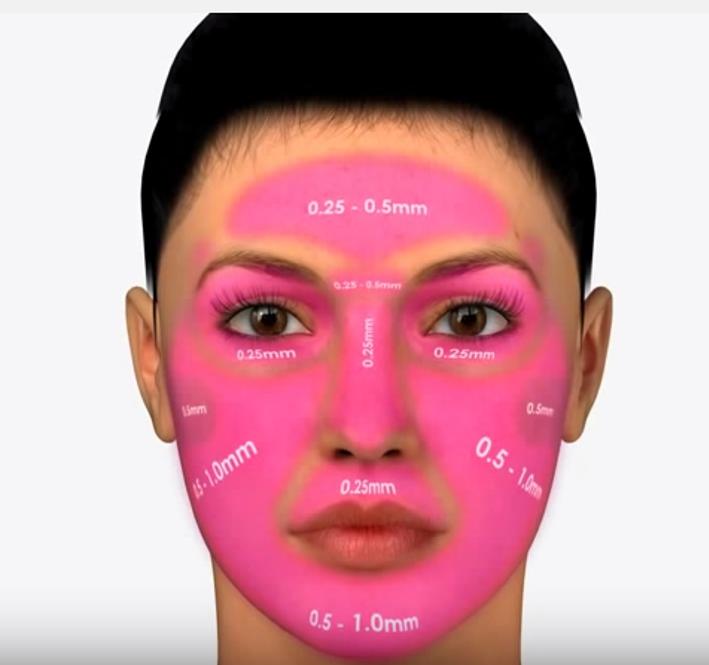 Microneedling Depth Guide